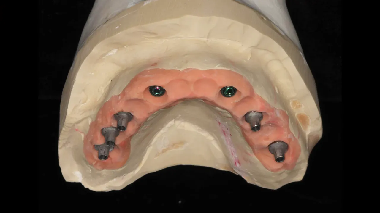 Model de lucru (master cast) montat pe masa de lucru