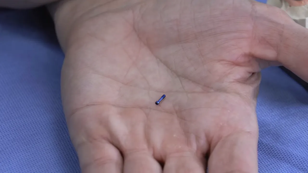 Șurub albastru mic utilizat pentru fixarea protezei pe implant