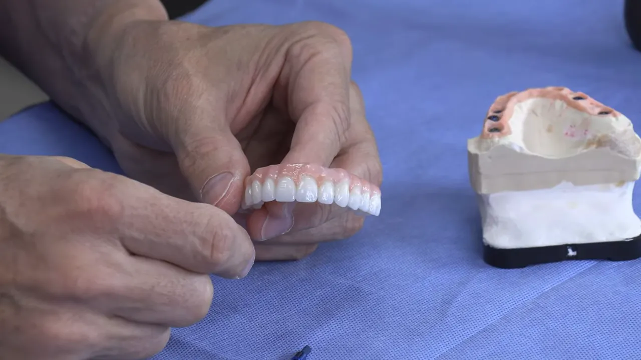 Proteză cu porțiuni roz care reprezintă os îndepărtat